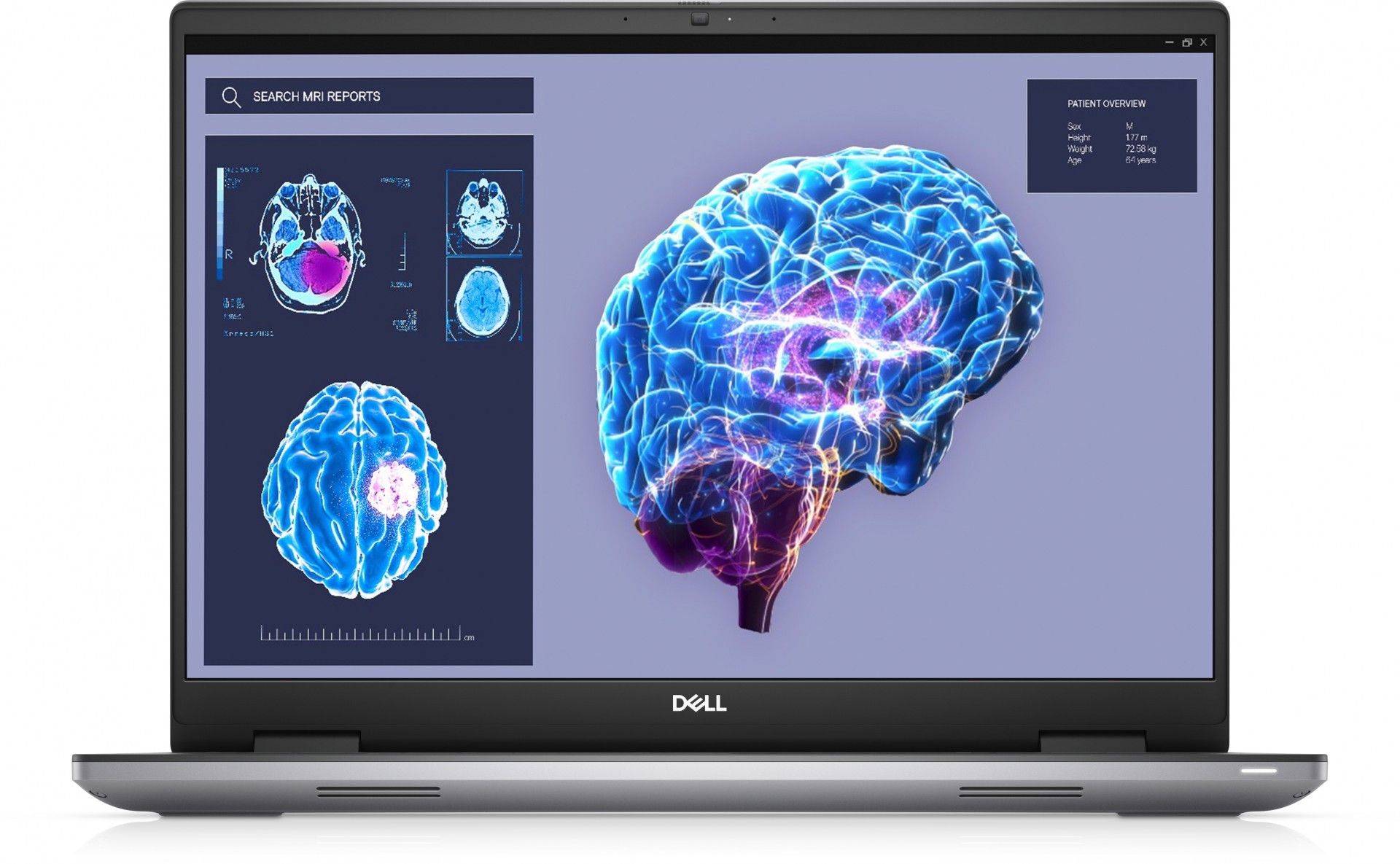 Dell N010P7680EMEA_VP